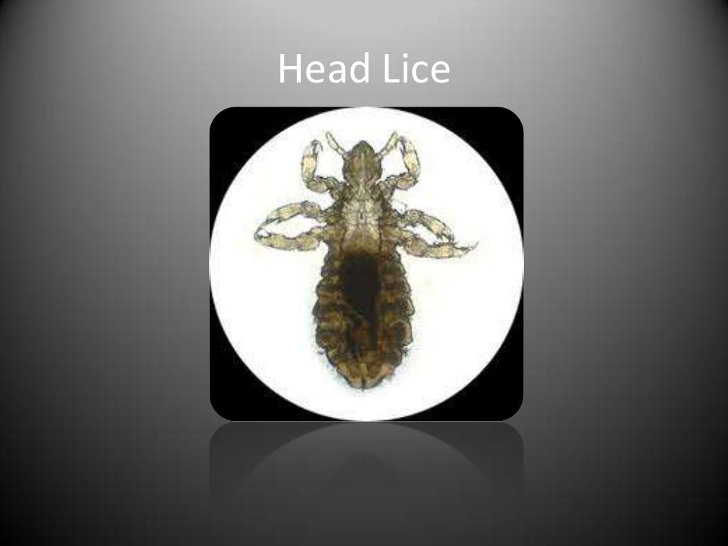 Difference between head lice, body lice and pubic lice