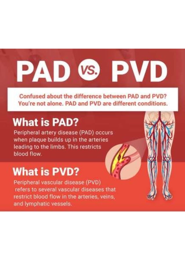PAD vs PVD What are the Differences? USA Vascular Centers PDF