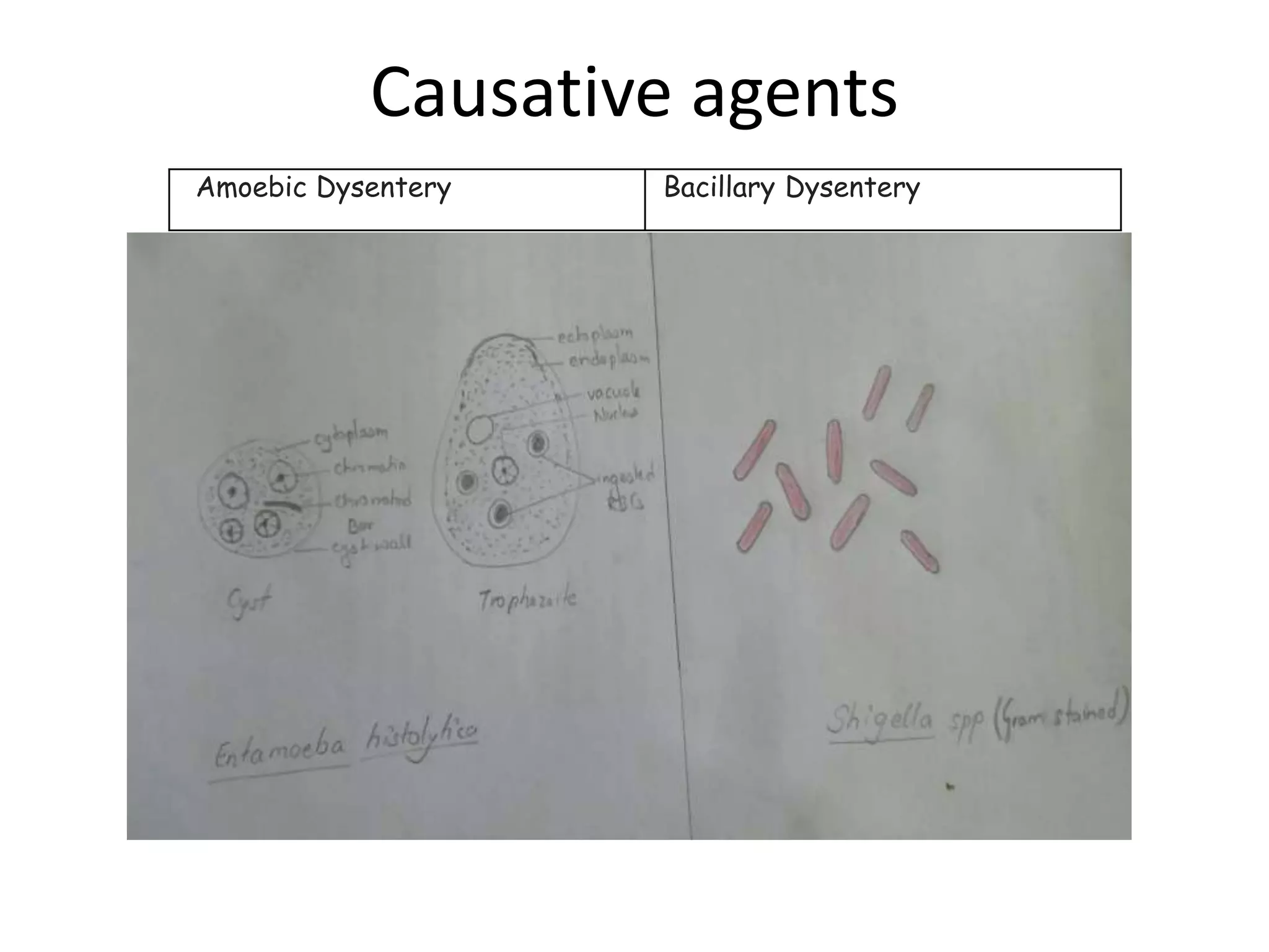 Differences between amoebic and bacillary dysentery