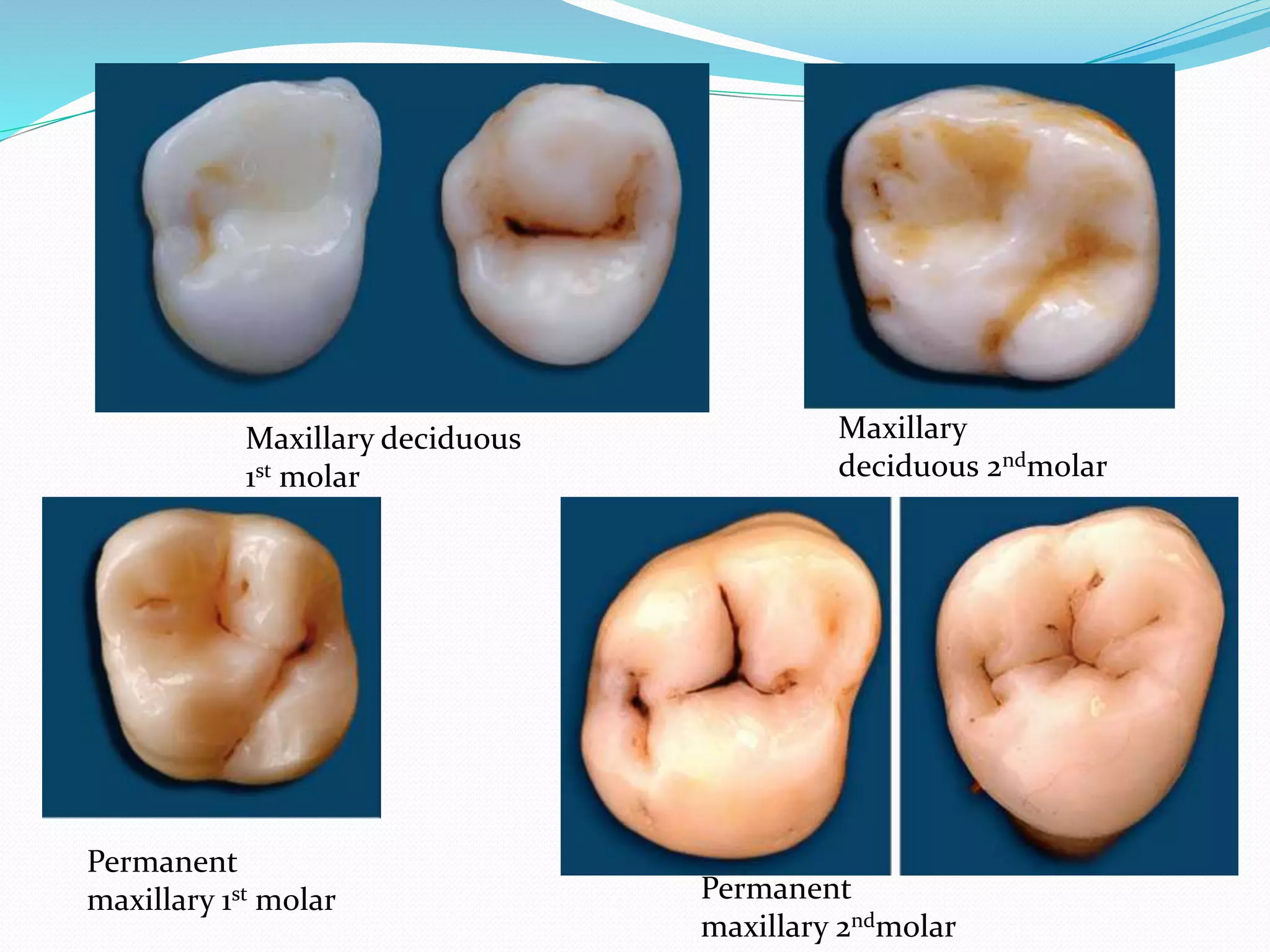 Differences between primary and permanent dentition ppt
