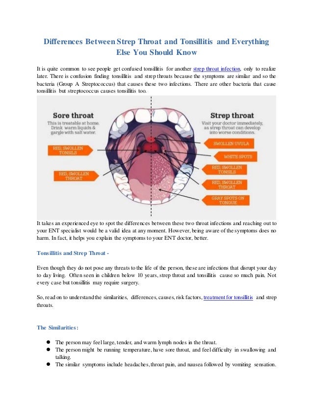 Differences Between Strep Throat And Tonsillitis