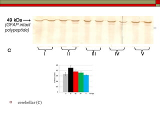    cerebellar (C)
 