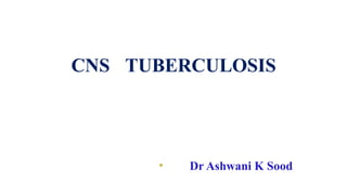 CNS TUBERCULOSIS
• Dr Ashwani K Sood
 