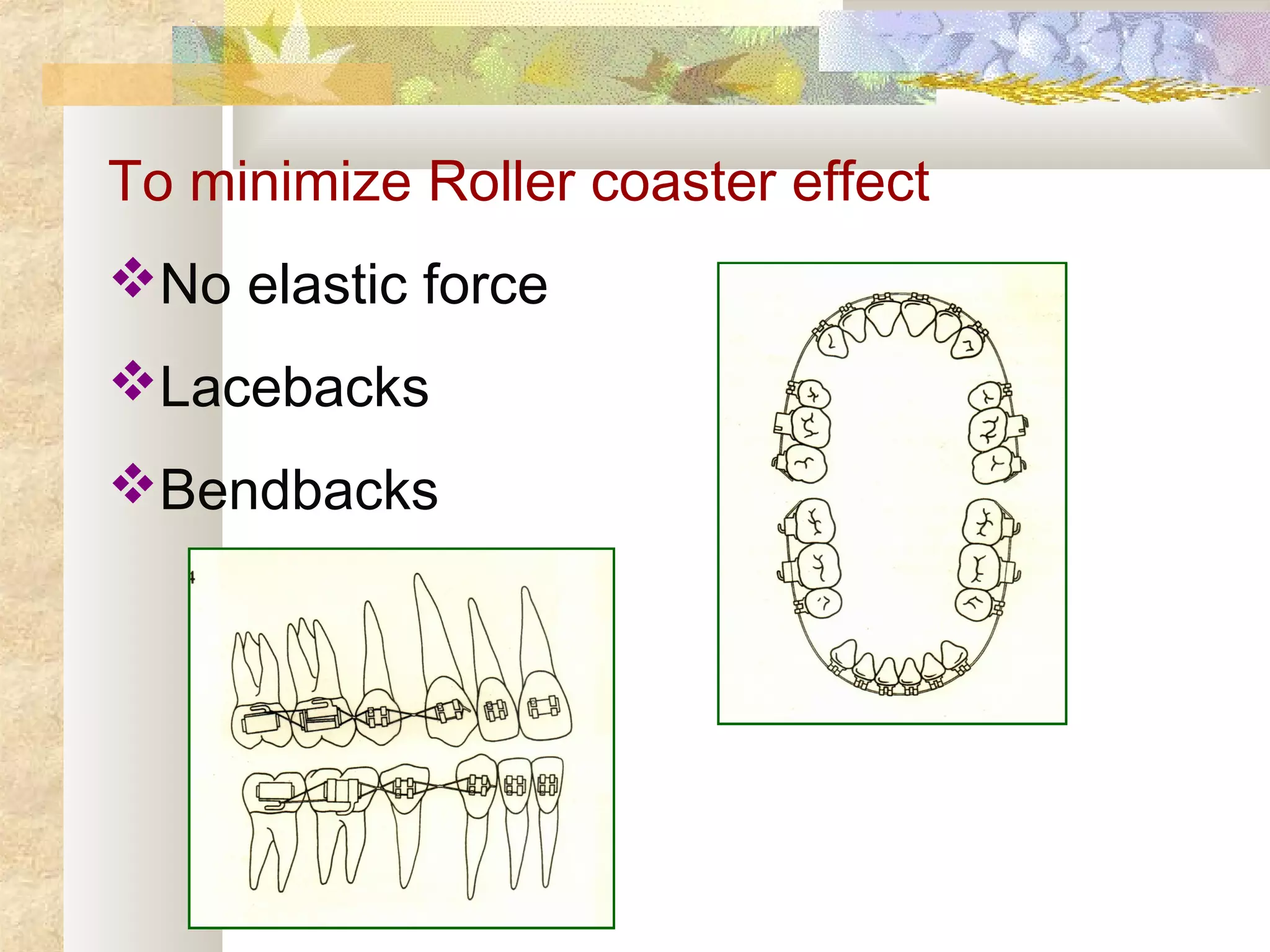 To minimize Roller coaster effect
No elastic force
Lacebacks
Bendbacks
 
