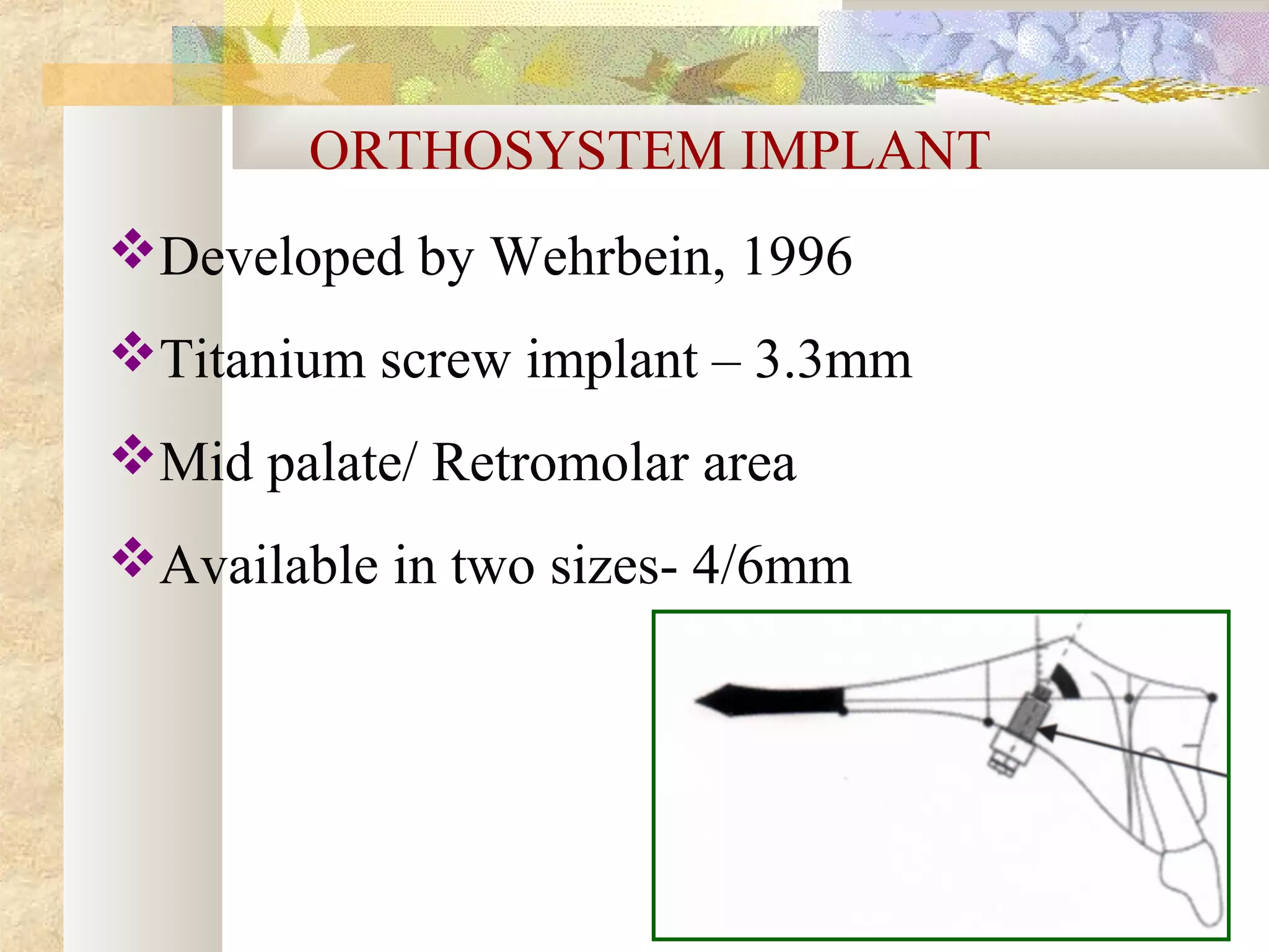 ORTHOSYSTEM IMPLANT
Developed by Wehrbein, 1996
Titanium screw implant – 3.3mm
Mid palate/ Retromolar area
Available in two sizes- 4/6mm
 