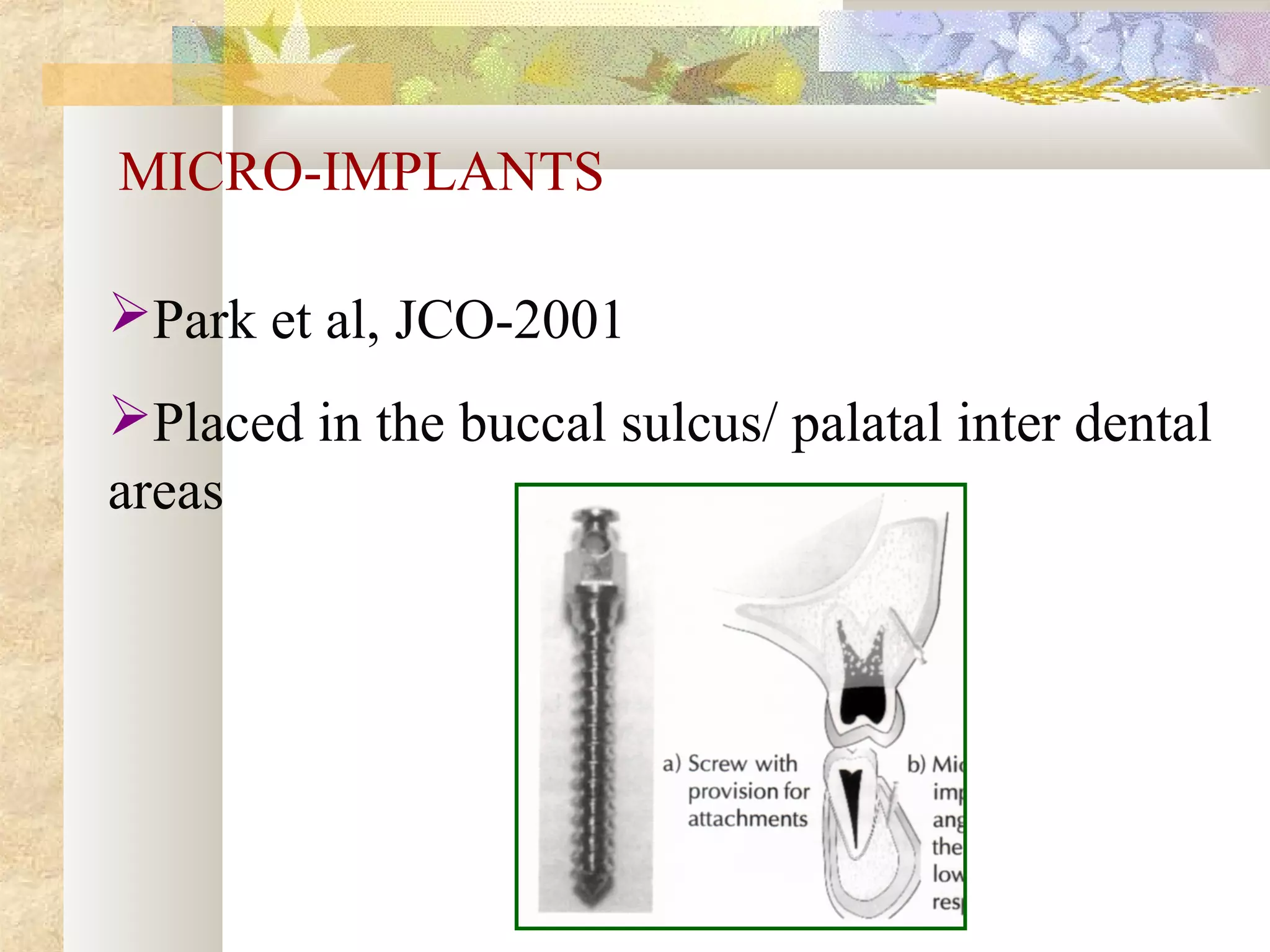 MICRO-IMPLANTS
Park et al, JCO-2001
Placed in the buccal sulcus/ palatal inter dental
areas
 