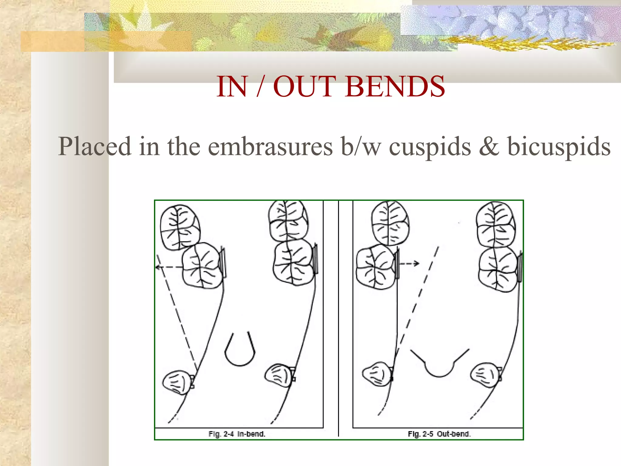 IN / OUT BENDS
Placed in the embrasures b/w cuspids & bicuspids
 