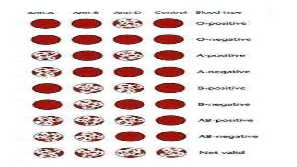 Different Blood Groups And Their Their Significances blood-groups-ppt