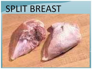 SPLIT BREAST
 