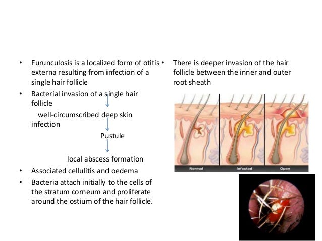 Different Ear Condition