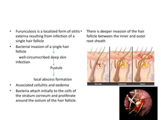 Different ear conditions | PPTX