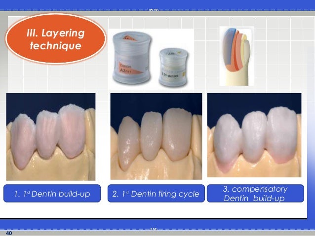 porcelain layering technique porcelain layering technique