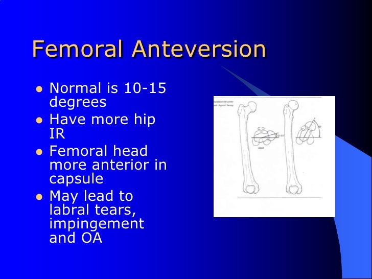 Differential Diagnosis Of The Hip2010
