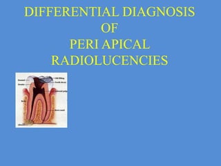 DIFFERENTIAL DIAGNOSIS
OF
PERI APICAL
RADIOLUCENCIES
 