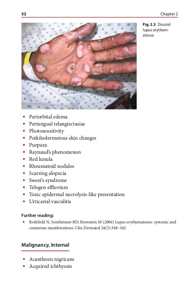 Differential diagnosis for the dermatologist