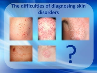 The difficulties of diagnosing skin
disorders
?
 
