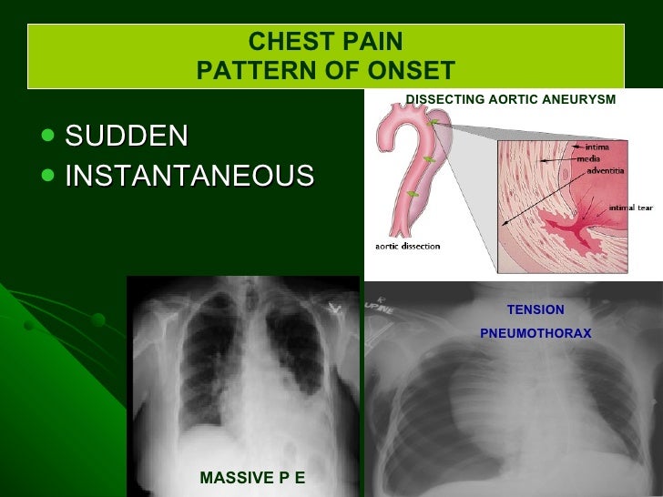 Differential diagnosis of chest pain by dr farooq on 29 0230 h.