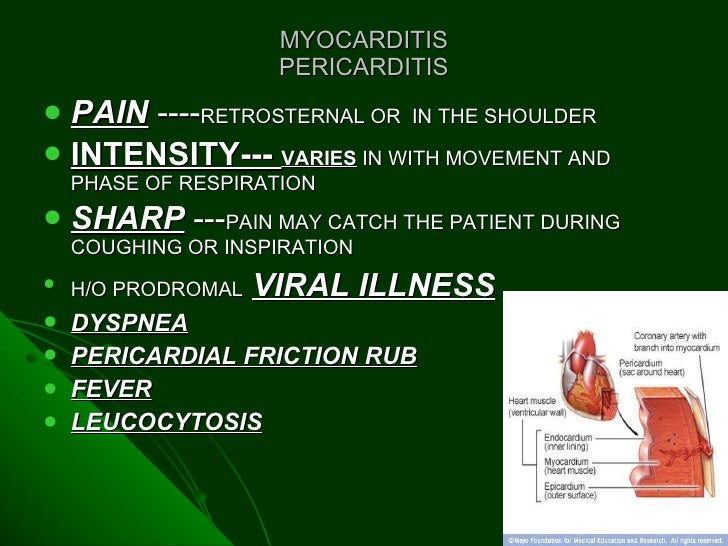 Differential diagnosis of chest pain by dr farooq on 29 0230 h.