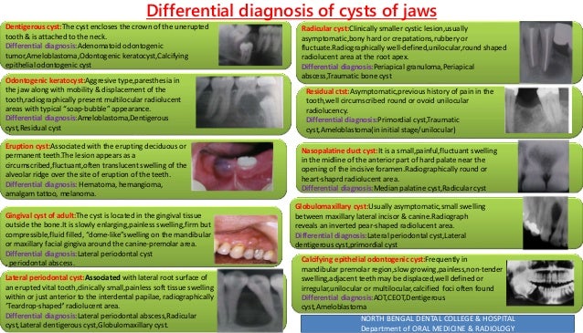 Differential diagnosis of cysts of jaws