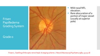 Differential Diagnosis of Disc Edema | PPTX