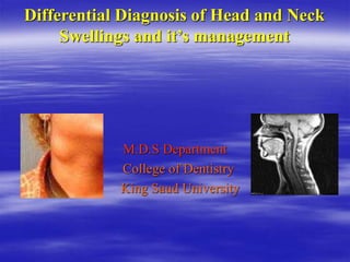 Differential Diagnosis of Head and Neck
Swellings and it’s management
M.D.S Department
College of Dentistry
King Saud University
 