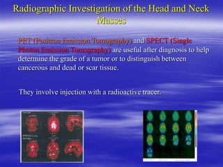 Radiographic Investigation of the Head and Neck
Masses
PET (Positron Emission Tomography) and SPECT (Single
Photon Emissio...