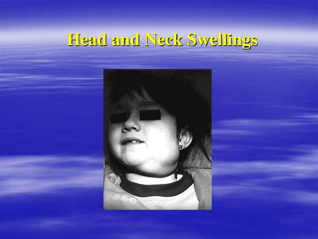 Differential diagnosis of head and neck swelling