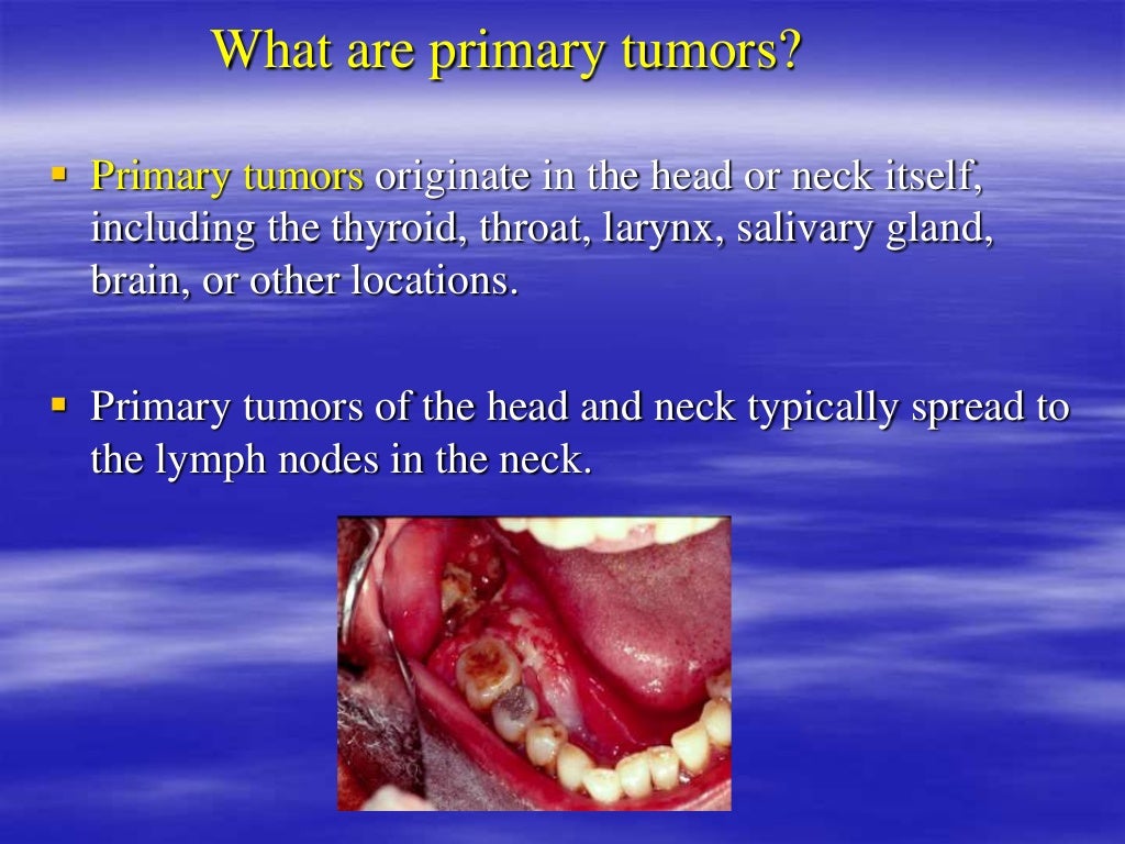 Differential diagnosis of head and neck swelling