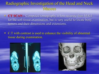 Radiographic Investigation of the Head and Neck
Masses
 CT SCAN – Computed tomography is less accurate than M.R.I
for the soft tissue examination, but is very useful to locate bony
tumors and their dimensions and extensions.
 C.T with contrast is used to enhance the visibility of abnormal
tissue during examination.
 