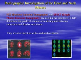Radiographic Investigation of the Head and Neck
Masses
PET (Positron Emission Tomography) and SPECT (Single
Photon Emission Tomography) are useful after diagnosis to help
determine the grade of a tumor or to distinguish between
cancerous and dead or scar tissue.
They involve injection with a radioactive tracer.
 