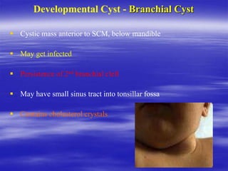 Developmental Cyst - Branchial Cyst
 Cystic mass anterior to SCM, below mandible
 May get infected
 Persistence of 2nd branchial cleft
 May have small sinus tract into tonsillar fossa
 Contains cholesterol crystals
 