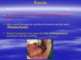 Ranula
 Ranula presents as a Cystic swelling in the floor of mouth.
 It occurs as a mucous extravasation from sublingual salivary
gland.•
 May extend through the mylohyoid muscles into the neck-
“Plunging Ranula”
 Surgical treatment is by removal of the Sublingual gland
associated with the swelling.
 
