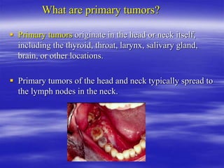 What are primary tumors?
 Primary tumors originate in the head or neck itself,
including the thyroid, throat, larynx, salivary gland,
brain, or other locations.
 Primary tumors of the head and neck typically spread to
the lymph nodes in the neck.
 