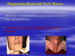 Diagnosing Head and Neck Masses
 Examination of some masses / swelling may allow a
physician to determine their cause based on location,
size, and consistency.
 In other cases, however, additional tests may be
required.
 