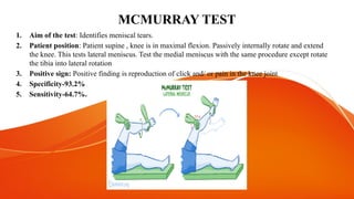 Maclure Test Example Differential Diagnosis and Special Tests for Knee Joint Injuries | PPTX