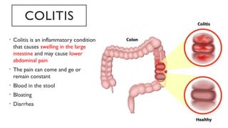 Differential diagnosis of lower abdominal pain | PPTX