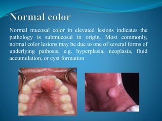 Differential diagnosis of oral and maxillofacial lesions | PPTX