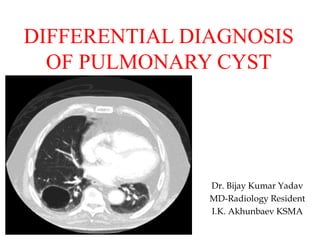 DIFFERENTIAL DIAGNOSIS
OF PULMONARY CYST
Dr. Bijay Kumar Yadav
MD-Radiology Resident
I.K. Akhunbaev KSMA
 