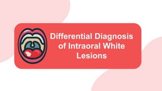 Differential Diagnosis
of Intraoral White
Lesions
 