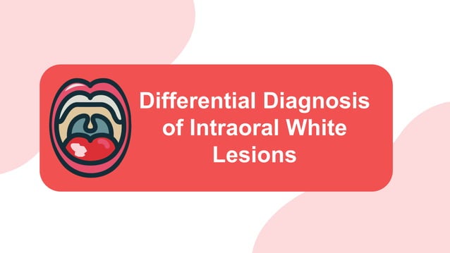 Differential Diagnosis of White Lesions in the oral cavity.pdf