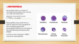 1neutrophilia
:
• Normal maturation stages of neutrophils :
Neutrophilia refers to number of
neutrophils that’s higher than normal
on a CBC with differential
.
(
absolute neutrophil count
7500
> /μ L in adults
)
-
Neutrophilia may result from a
shift of cells from the marginal to
the circulating pool (shift
neutrophilia) without an increase in
the total blood granulocyte pool
(TBGP)
-
or from a true increase in TBGP
size (true neutrophilia)
.
 