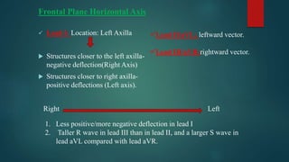 DIFFERENTIALS OF ARRYTHMIAS WITH RBBB MORPHOLOGY.pptx