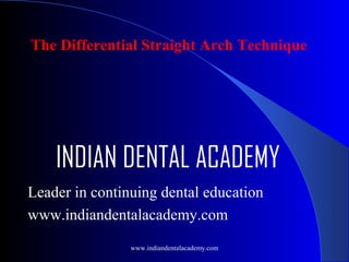 The Differential Straight Arch Technique

INDIAN DENTAL ACADEMY
Leader in continuing dental education
www.indiandentalacademy.com
www.indiandentalacademy.com

 