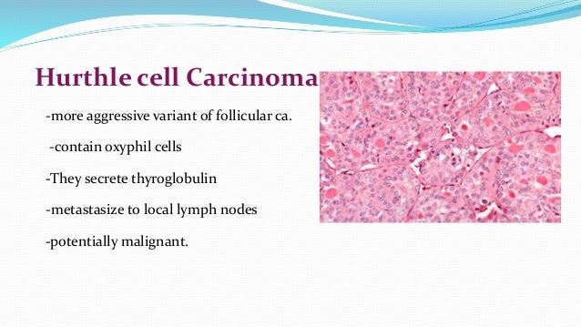 Differentiated thyroid carcinoma
