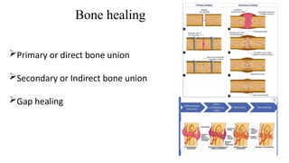 Comprehensive Overview of Osteosynthesis Fixation Methods for ...