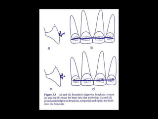 Different Tooth Movement.pptx