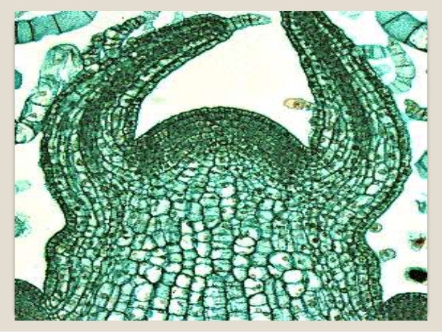 Different type of plant cell in tissue system of plant