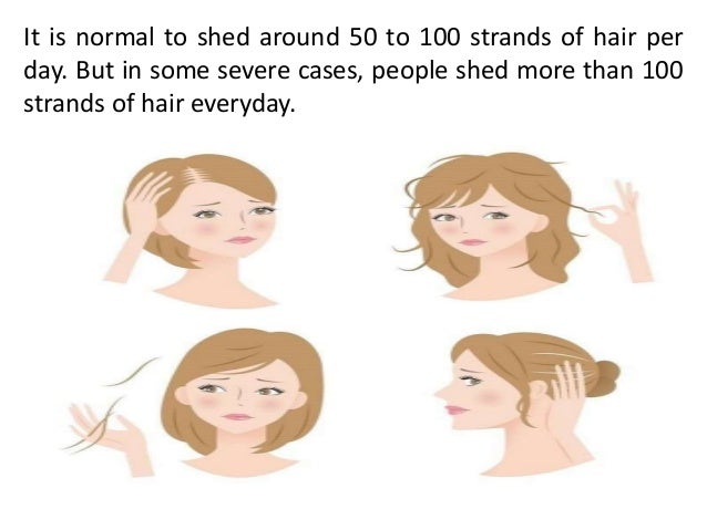 Different Types Of Alopecia