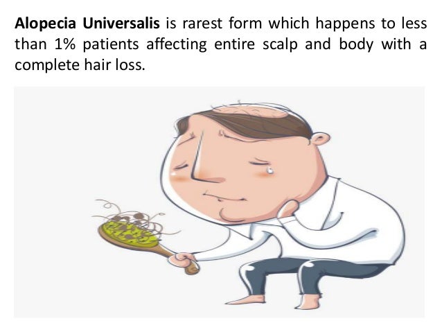 Different Types Of Alopecia