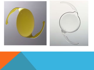 Iol Types TYPES OF INTRAOCULAR LENSES.pptx
